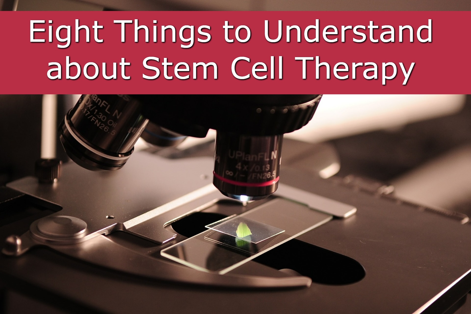 Eight Things to Understand about Stem Cell Therapy