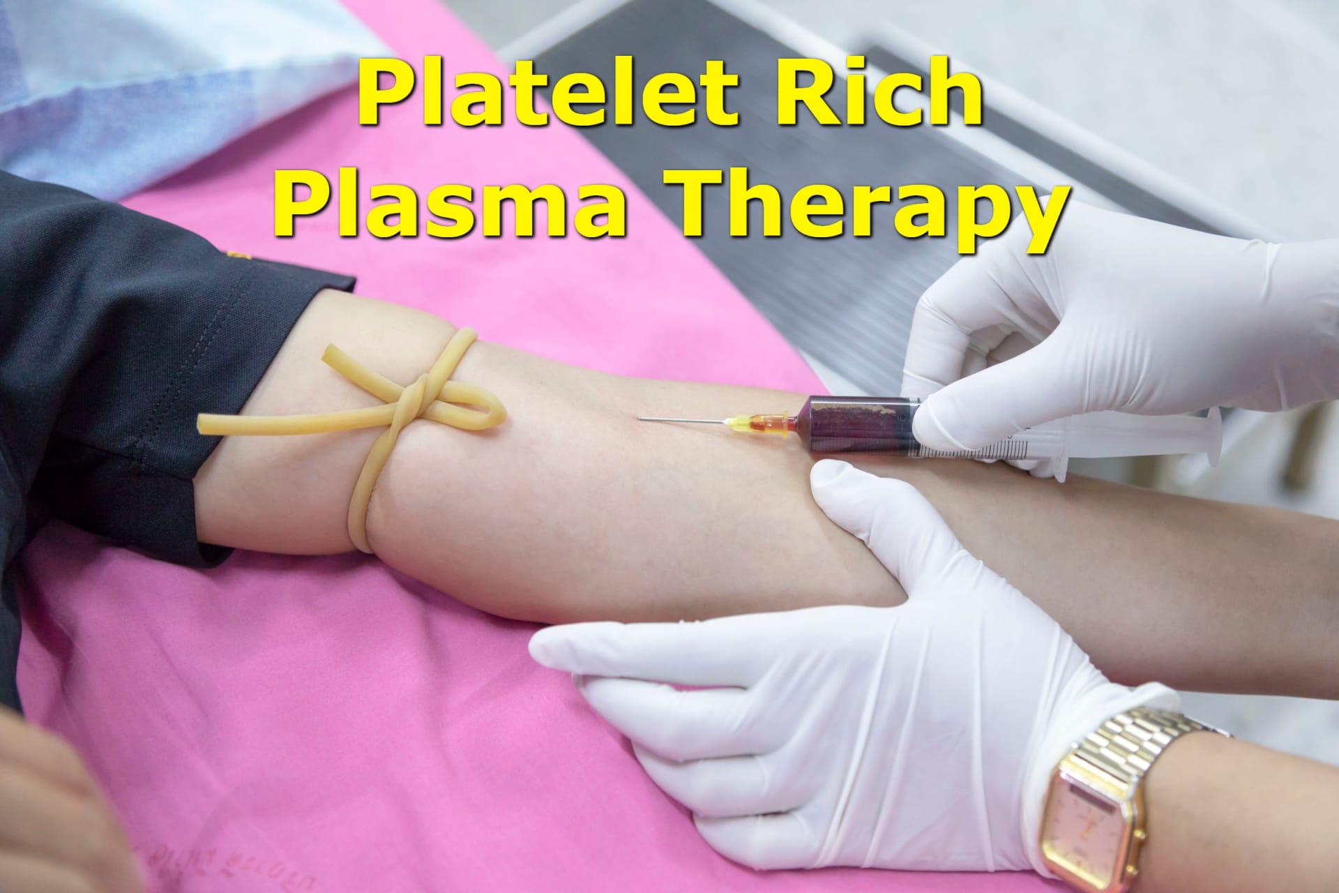 A blood draw for PRP Therapy